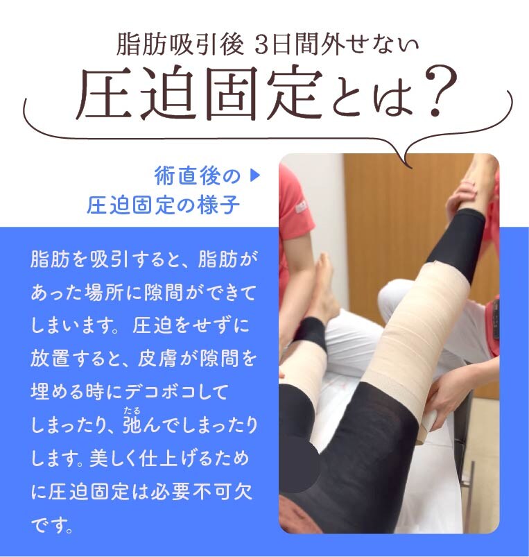 脂肪吸引圧迫着3点セット (ボレロ・ガードル・ウエストニッパー） うまし 