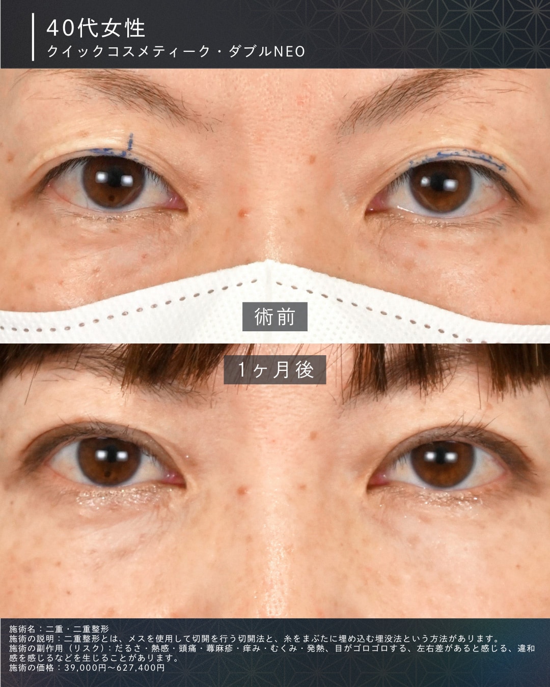 40代女性の症例
