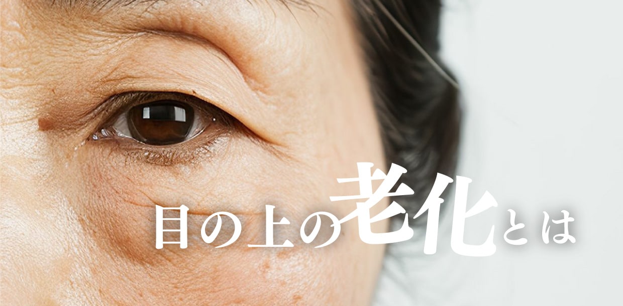 まぶたの皮膚のたるみ