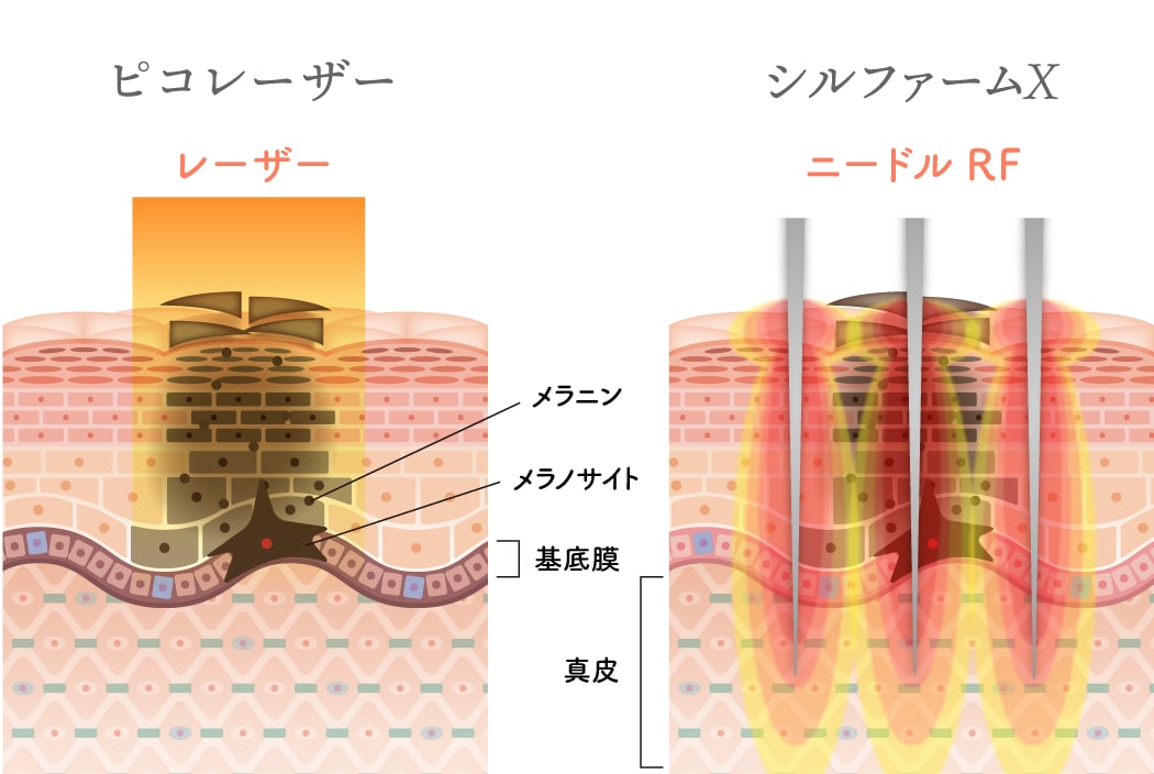 【徹底比較】「黒」を攻撃するか、「赤」と「土台」をケアするか