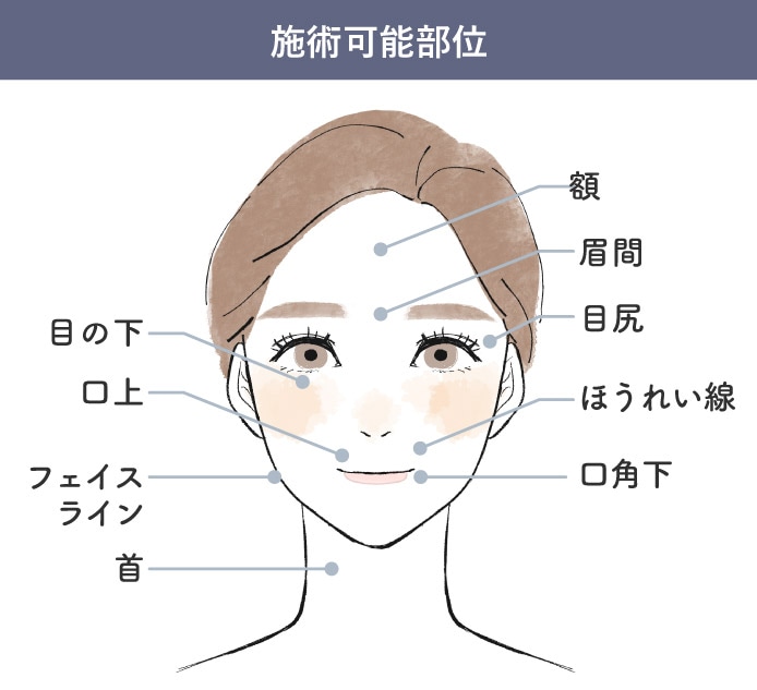 1回4本のセットメニュー
