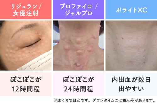 Q. ダウンタイムはありますか？