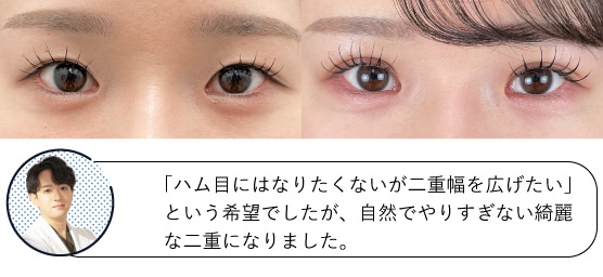 23歳女性の症例