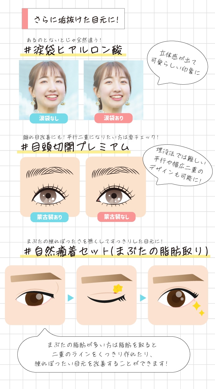 埋没だけじゃない!垢抜け二重のための美容整形