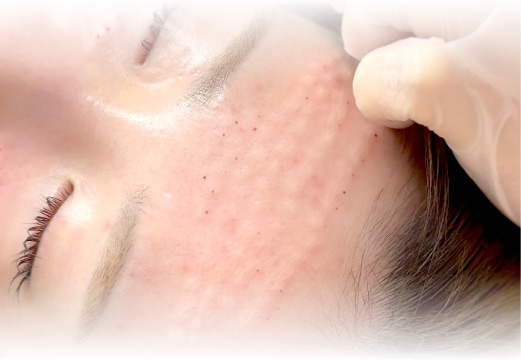 施術中の痛みについて