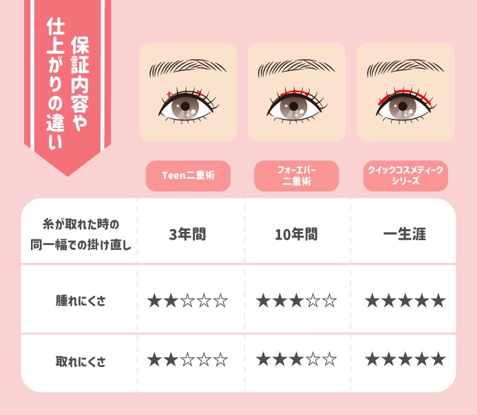 3つの埋没法の違い