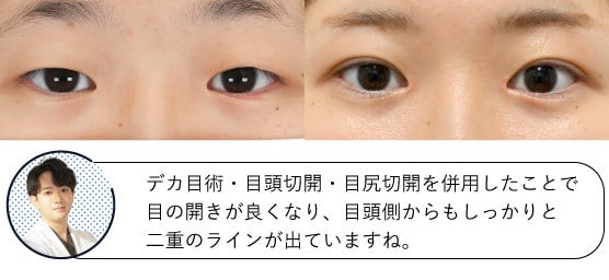 17歳女性の症例