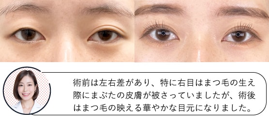 23歳女性の症例