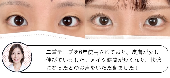 21歳女性の症例