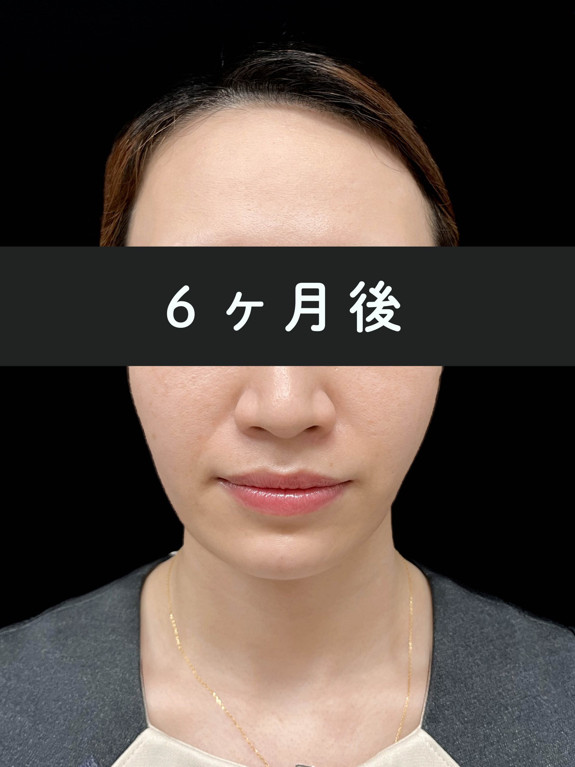6ヶ月後