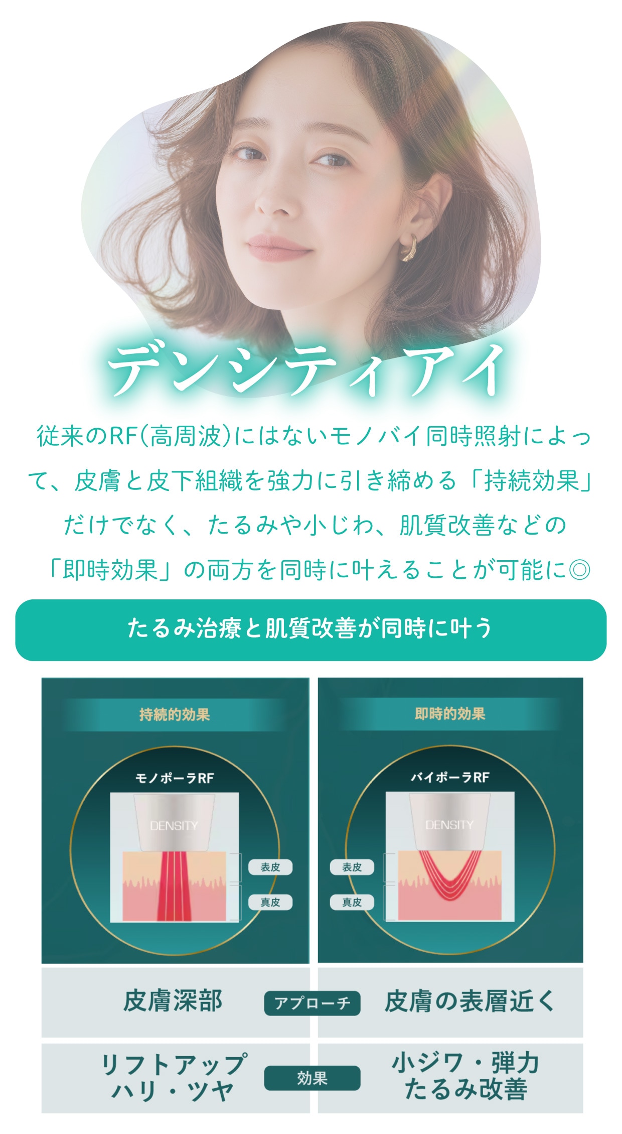 デンシティアイ