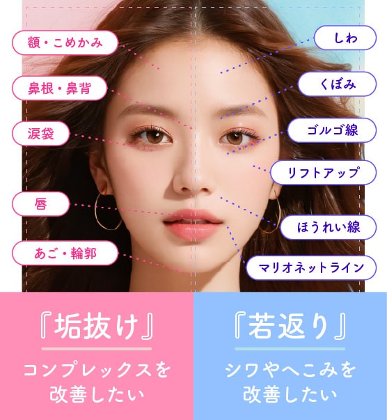 湘南美容クリニック京都院のヒアルロン酸｜対応可能部位