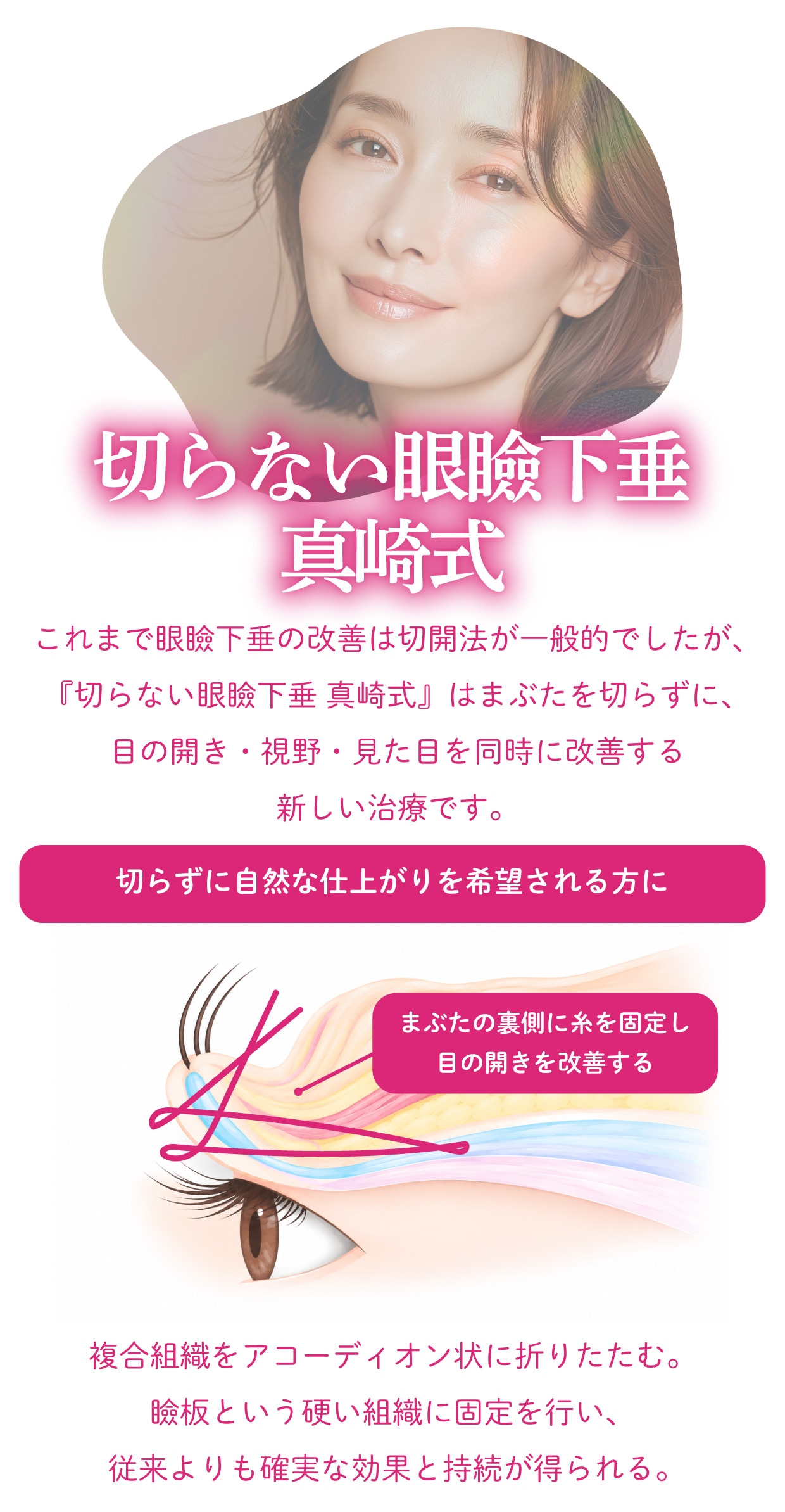 切らない眼瞼下垂真崎式