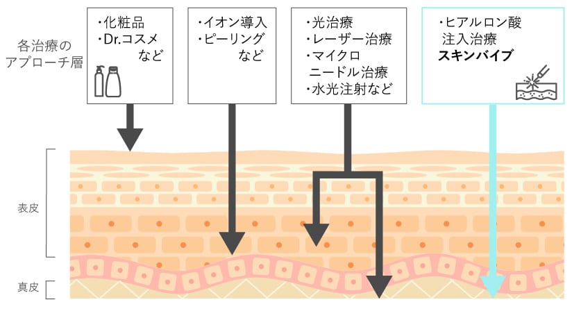 肌質改善で用いられている主な治療とは？