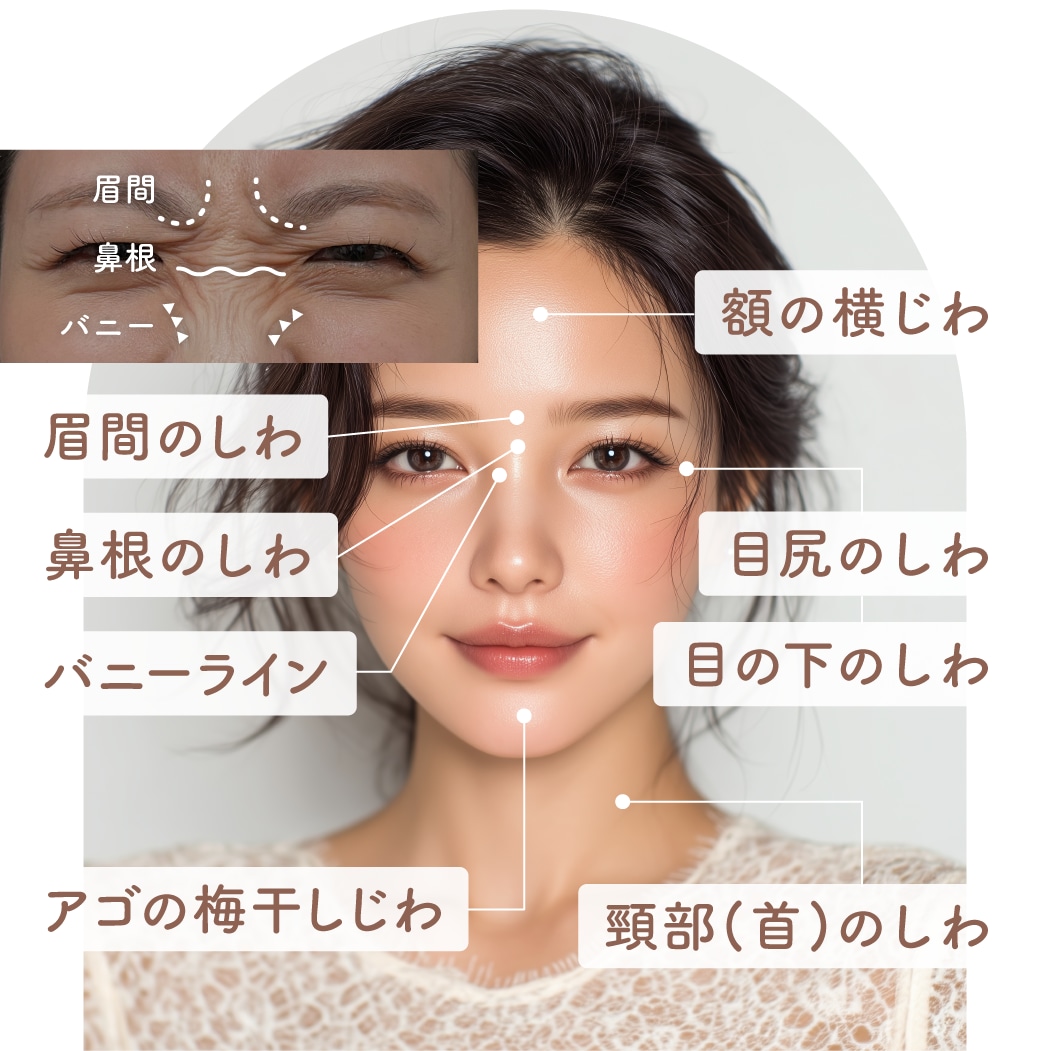 表情じわの改善に
