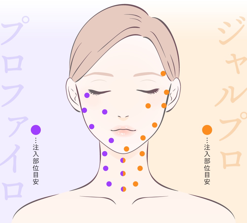 注入場所（打つ場所）