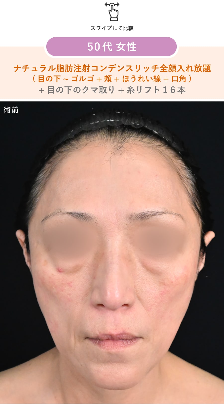 術前