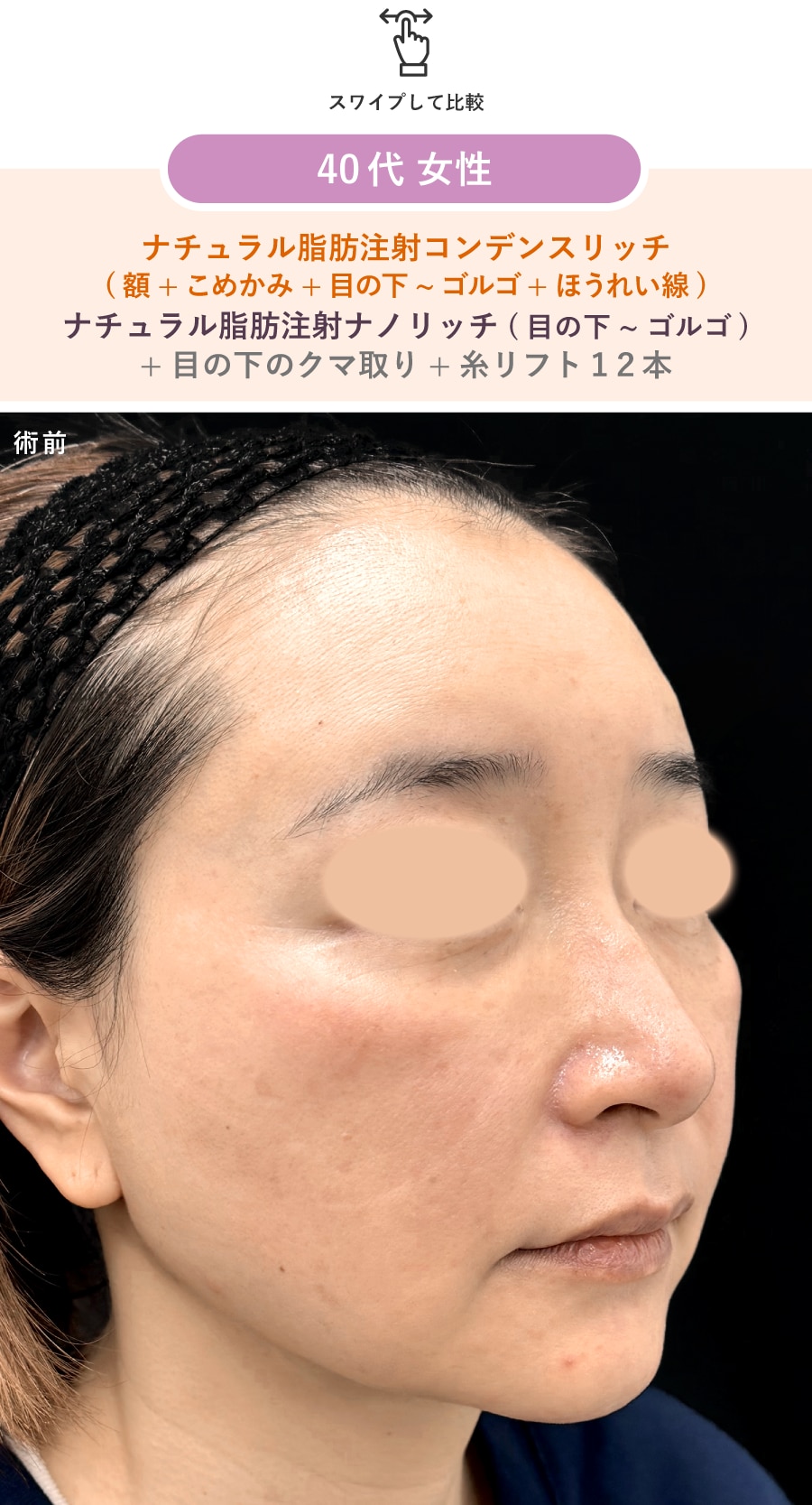 術後
