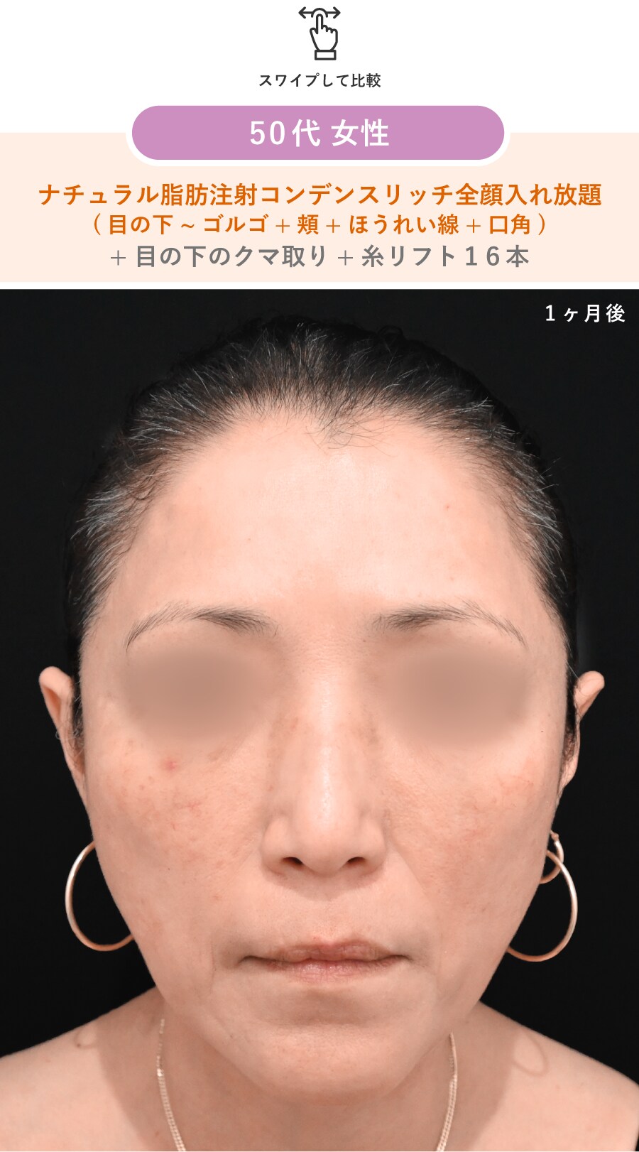 術後