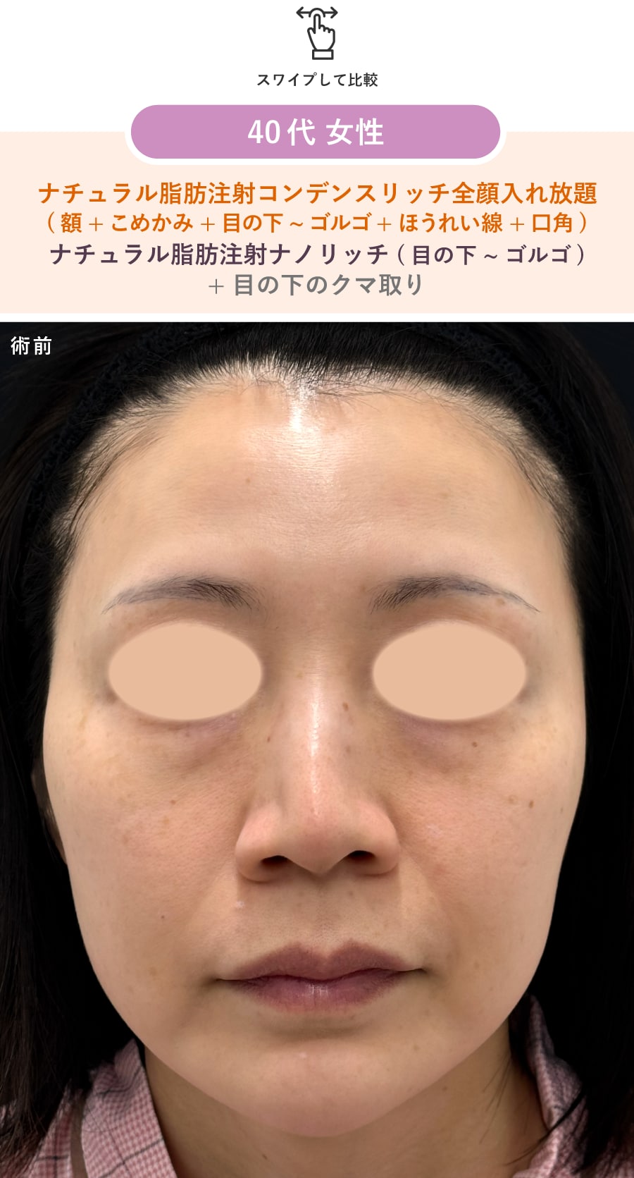 術前