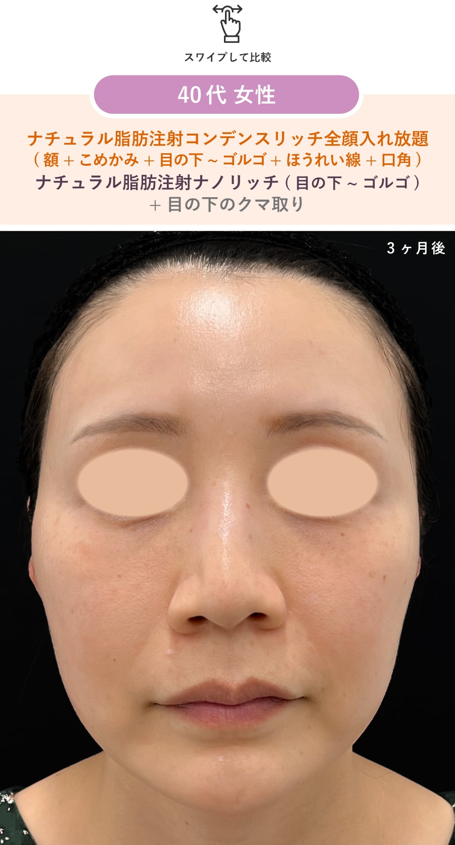術後