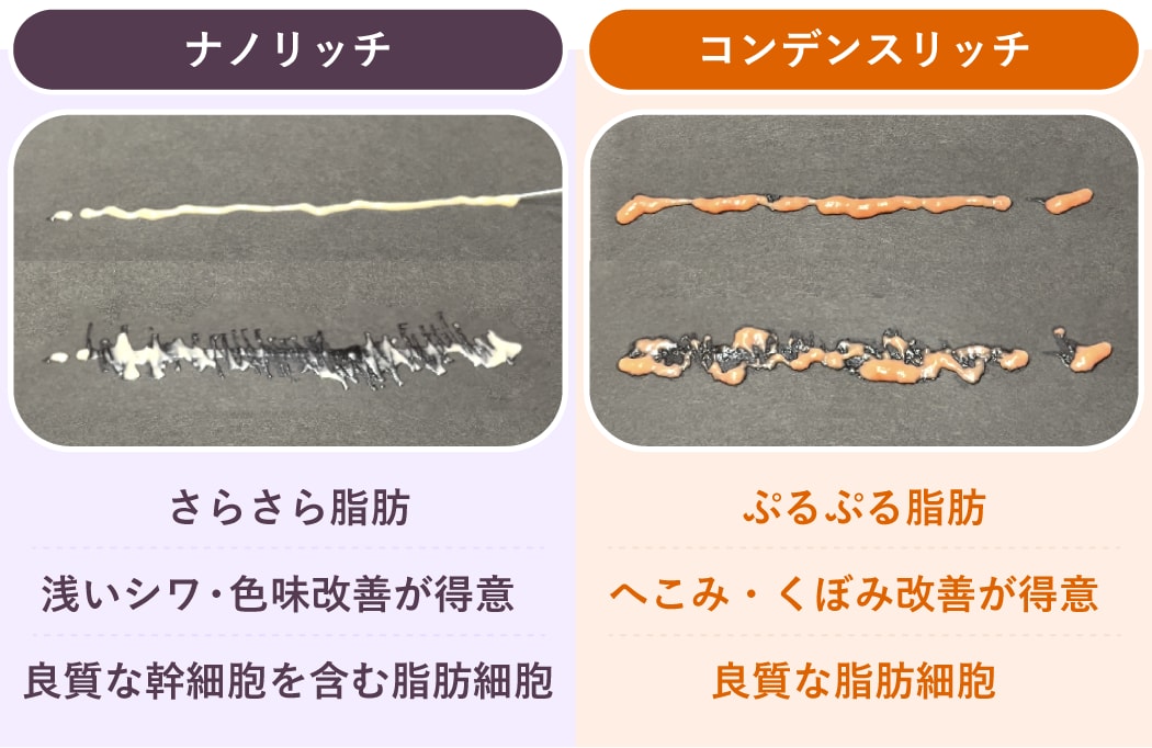 【ボリュームUP】と【肌質改善】<br />
目的に合わせて使い分ける高濃度脂肪