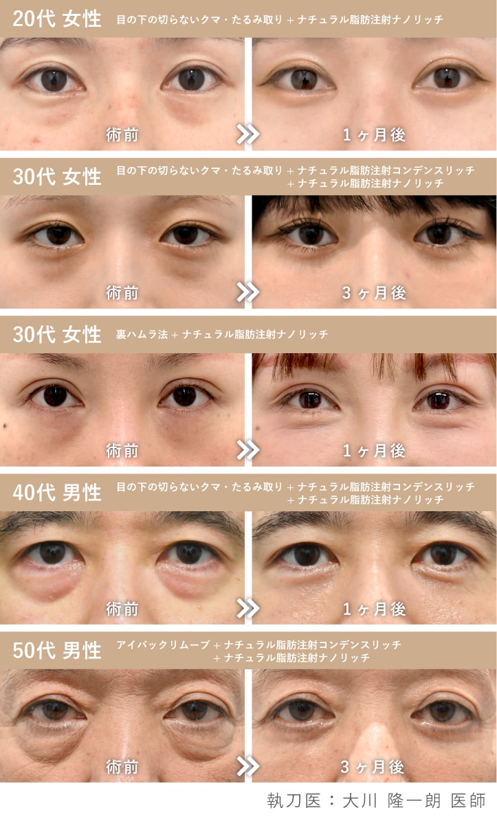 京都】目の下のクマ取り・たるみ取りならSBC京都院。全術式対応の名医2名が在籍 - 京都院, image size:723x1189