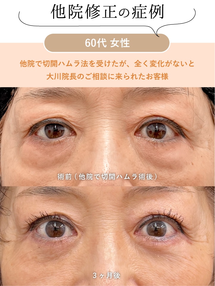 「クマが消えていない」「納得できない」…修正依頼が絶えない現実