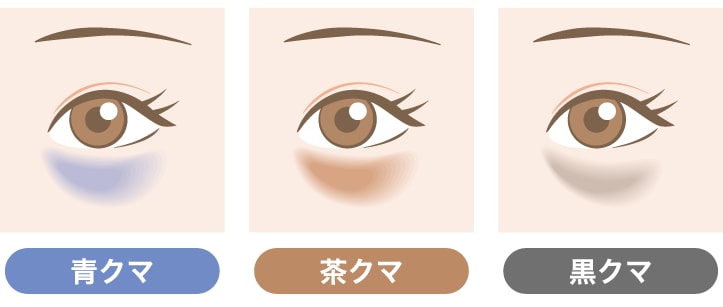 まずは鏡でチェック！3大クマ（黒・赤・青）の見分け方