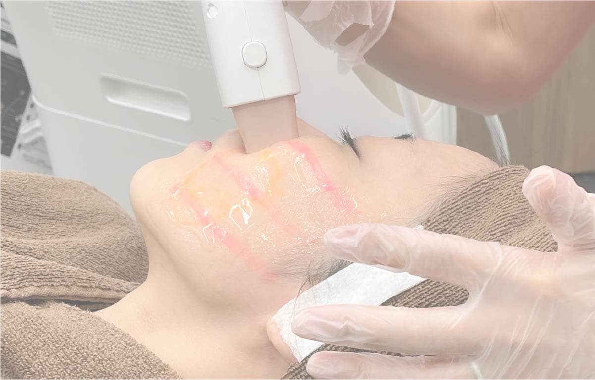 仕上がりを変える「最適ショット数の提案」と、医師×看護師のチーム医療