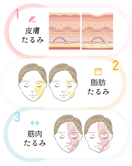 あなたのたるみはどのタイプ？原因を知って最適な治療を