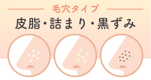 [ 治療の方向性 ]<br />
<strong>皮脂コントロール・洗浄・ピーリング</strong>