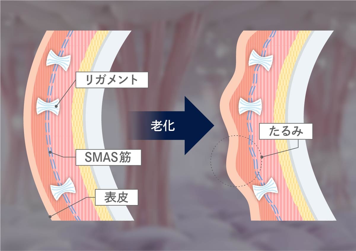 次世代の美肌治療「ジャルプロ スーパーハイドロ」とは