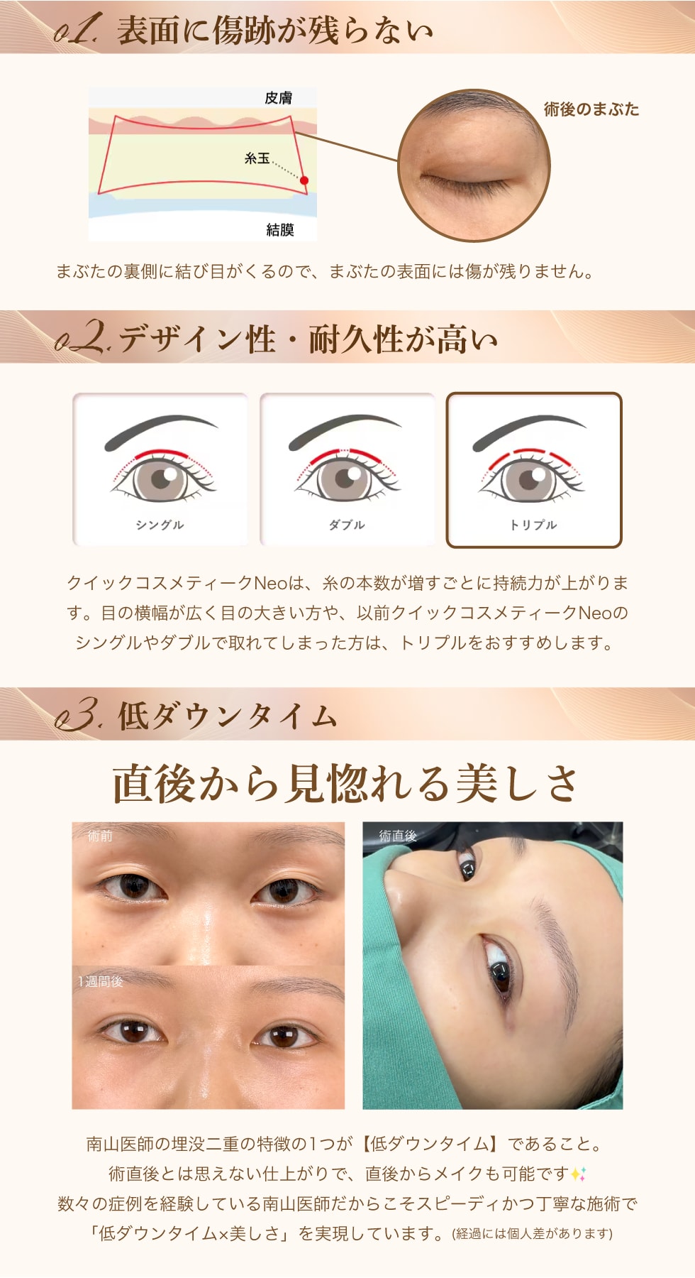 クイックコスメティーク・トリプルの特徴って？