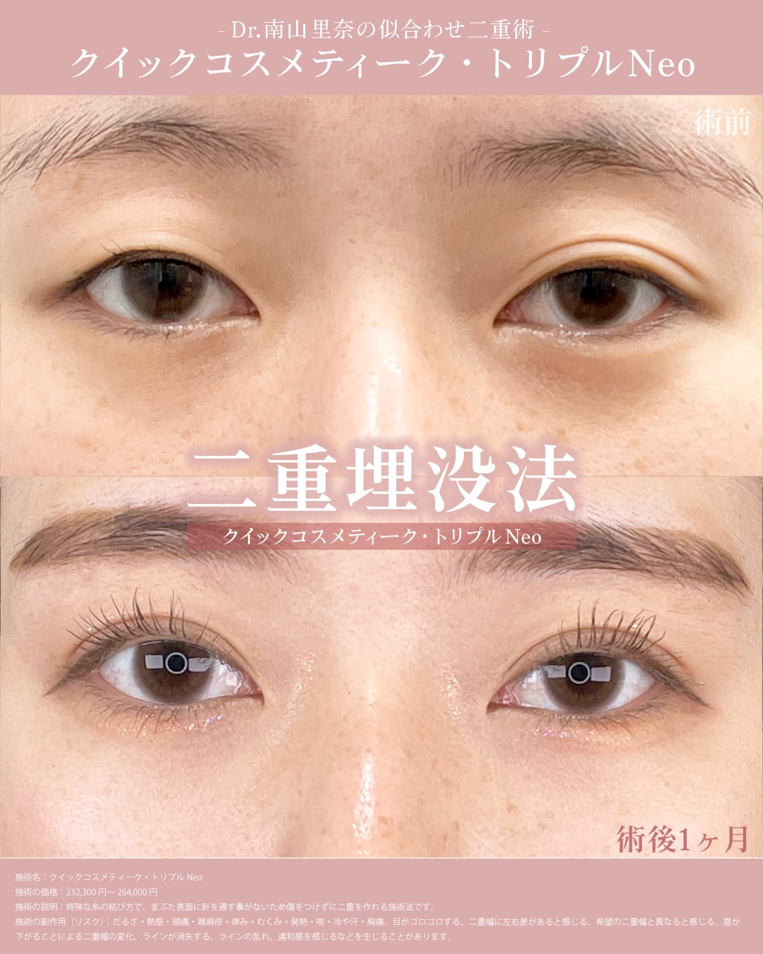 左右差のある目元を改善したい