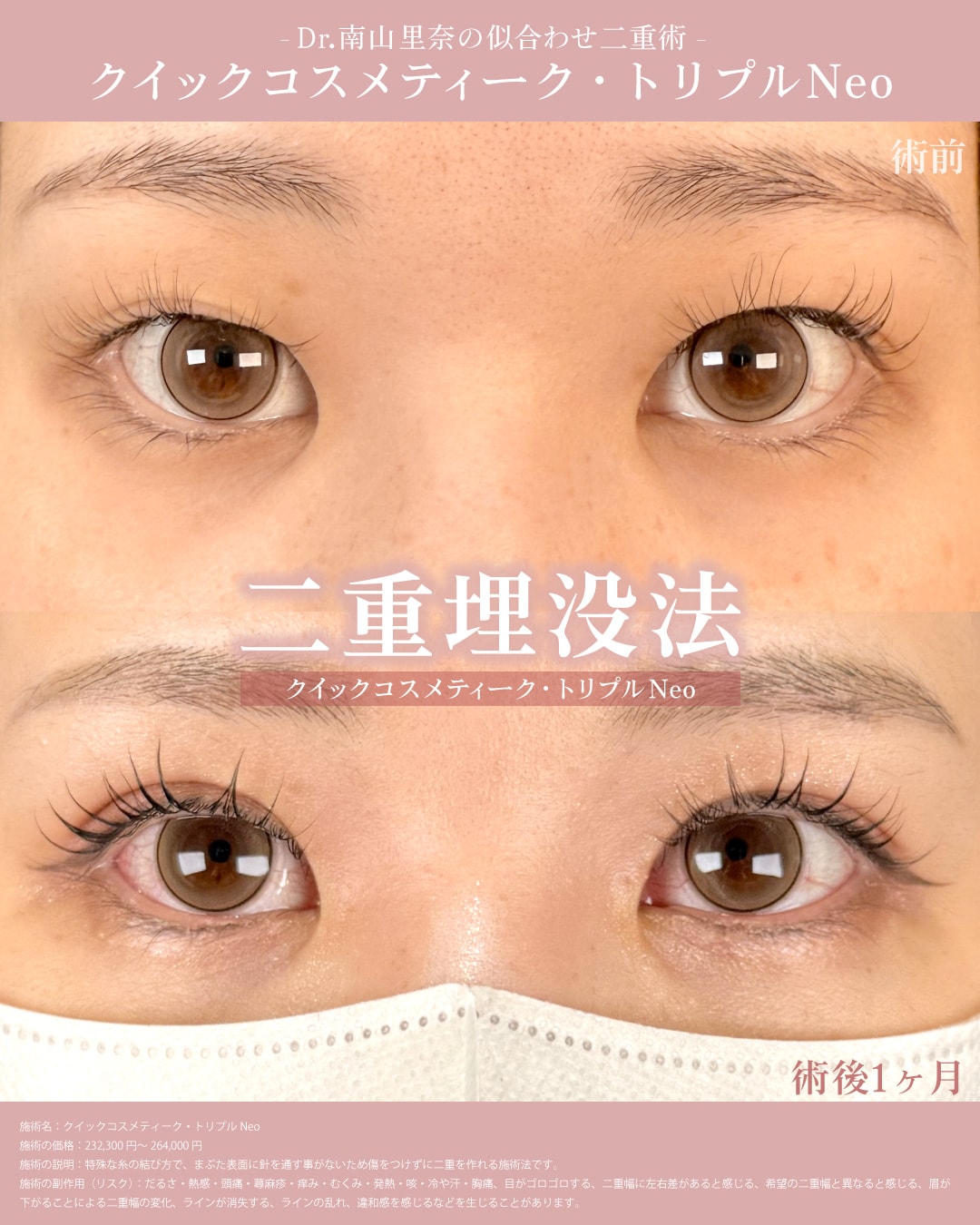 メイクが映える目元になりたい