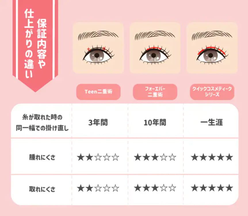 3つの埋没法の違い