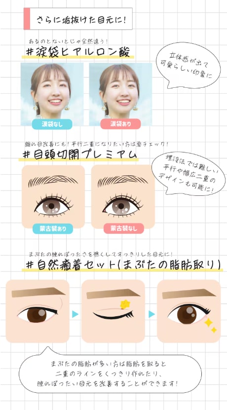 埋没だけじゃない！垢抜け二重のための美容整形