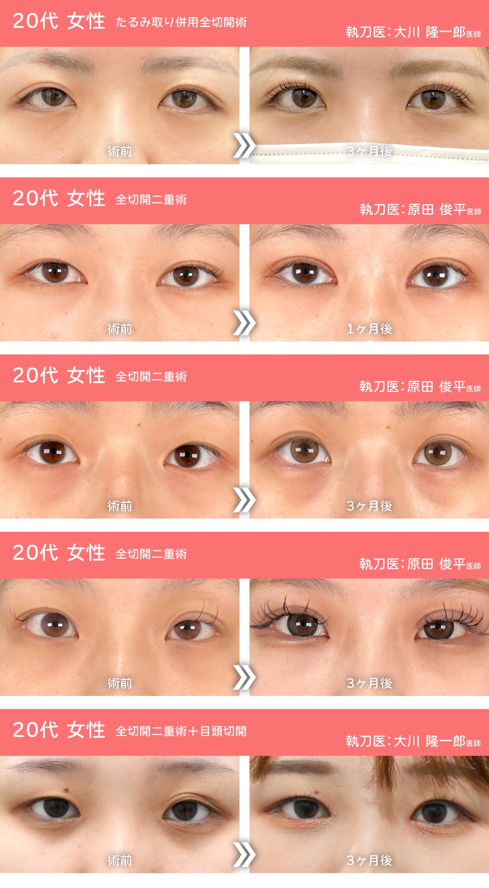 切開にも対応できる幅広い提案力