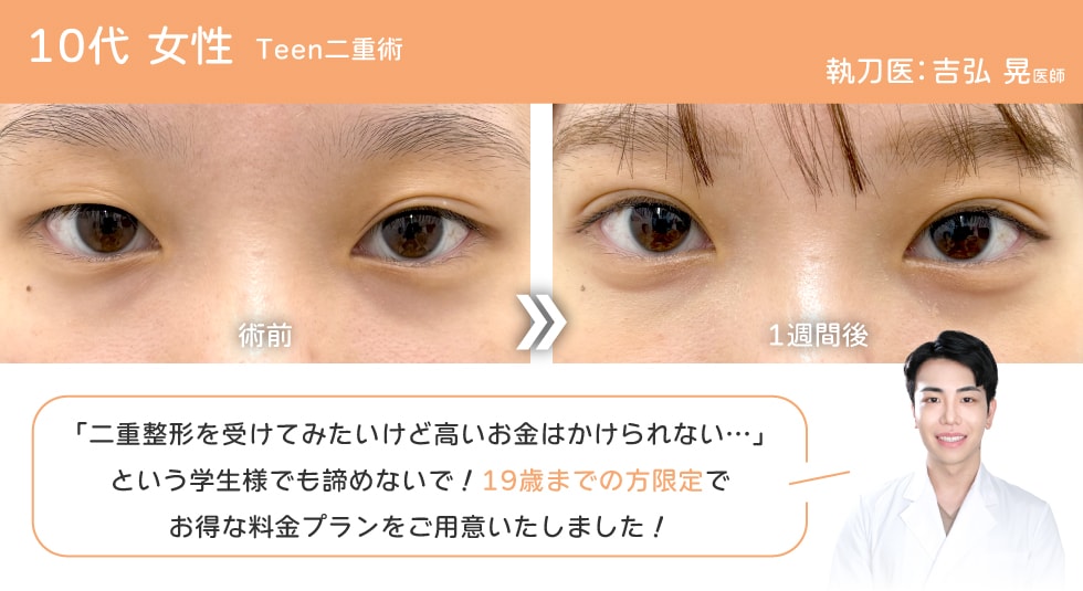 19歳までのお客様限定！お得なプランも