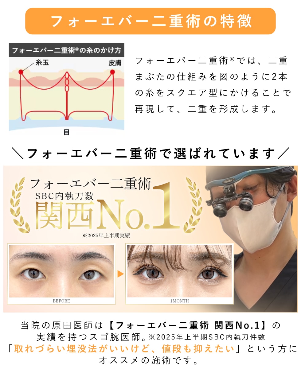 持続性を重視しつつ価格は抑えたい方に【フォーエバー二重術】