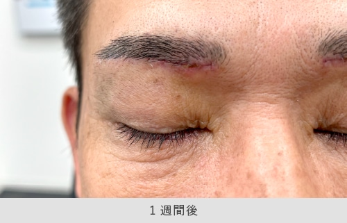 限界を見極める「緻密なデザイン」で機能障害を防ぐ