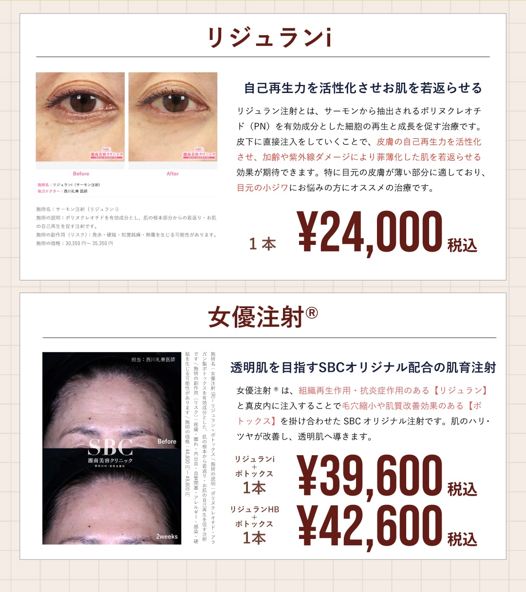 3月はリジュランi・女優注射がお得