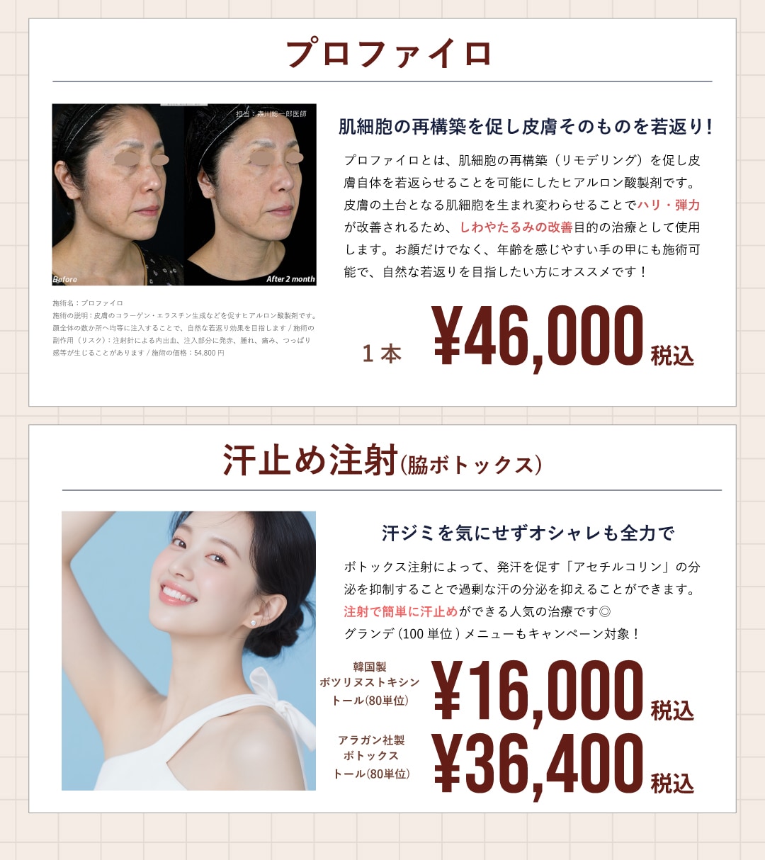 4月はプロファイロ・汗止め注射がお得