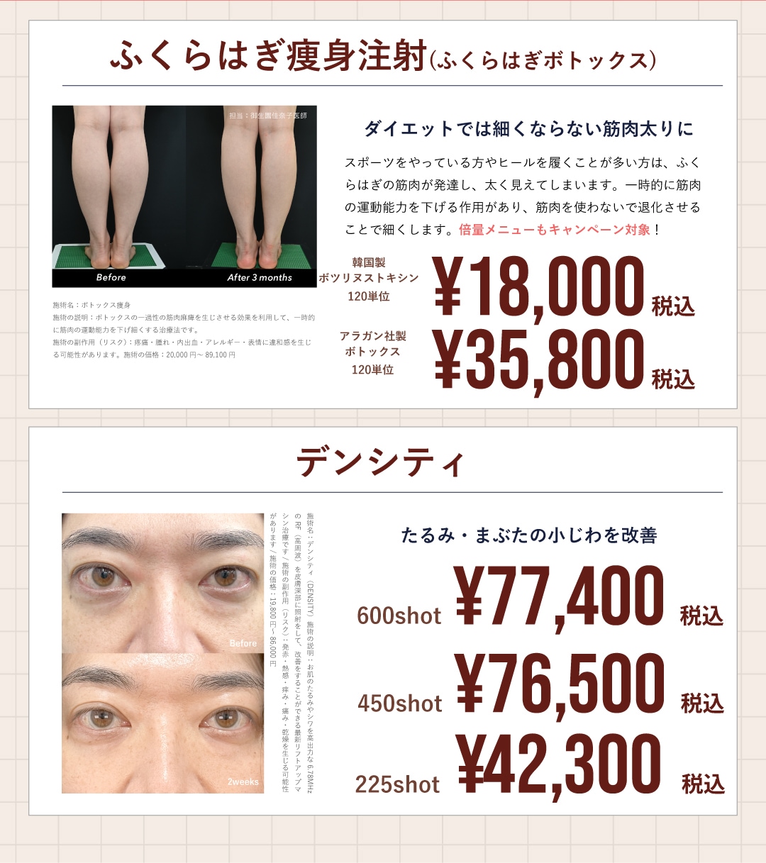 4月はふくらはぎ痩身治療・デンシティがお得