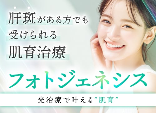 フォトジェネシス(ステラM22)による美肌・光治療