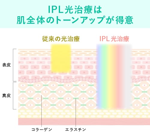 真皮への肌育（光治療版）で叶える、次世代の若返り