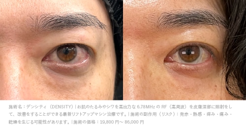 京都 デンシティ 症例写真