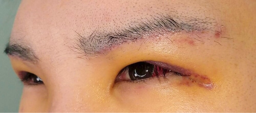 他院医師の経過