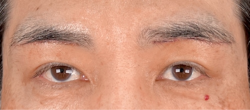 原田医師の経過